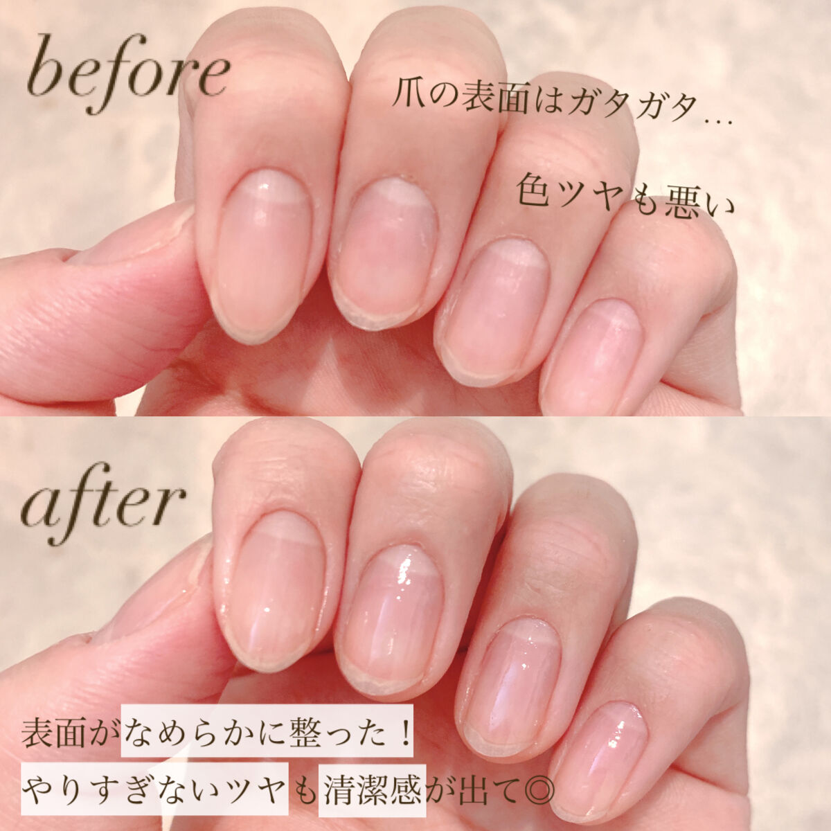 自爪補強コート/デュカート/ネイルベースコートを使ったクチコミ（2枚目）