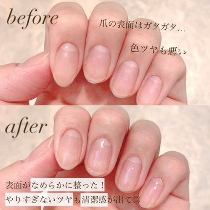 自爪補強コート/デュカート/ネイルベースコートを使ったクチコミ(2枚目)