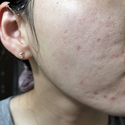 ビオオイル アルガンオイル/Melvita/フェイスオイルを使ったクチコミ(2枚目)