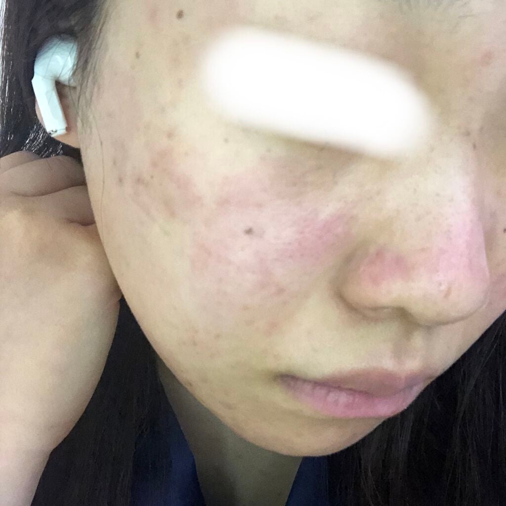 明色美顔水 薬用化粧水/美顔/化粧水を使ったクチコミ(2枚目)