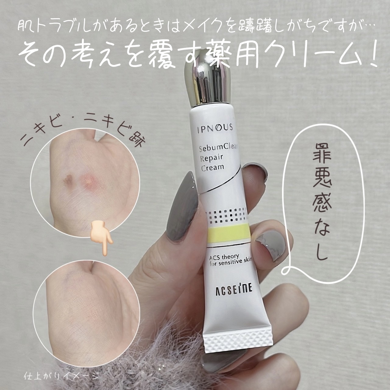 ACSEINE イプノス シーバムクリア リペアクリームのクチコミ「＼ニキビを忘れる／色付き薬用クリーム✊🏻❤︎
 
୨୧┈┈┈┈┈┈┈┈┈┈┈┈୨୧
 
アクセ.....」（1枚目）