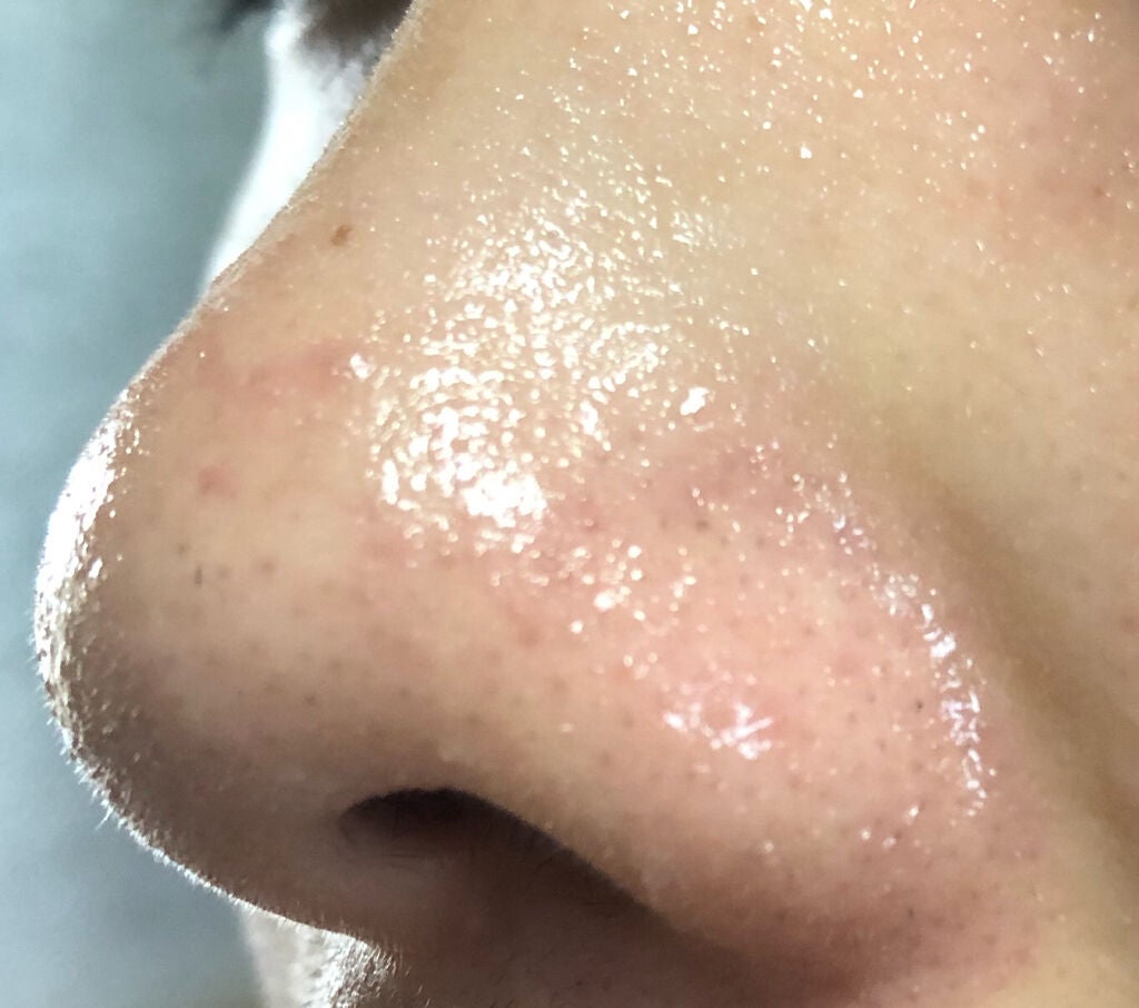 ノーモアブラックヘッド(ノーズピーリング)/One-day's you/スクラブ・ゴマージュを使ったクチコミ(5枚目)