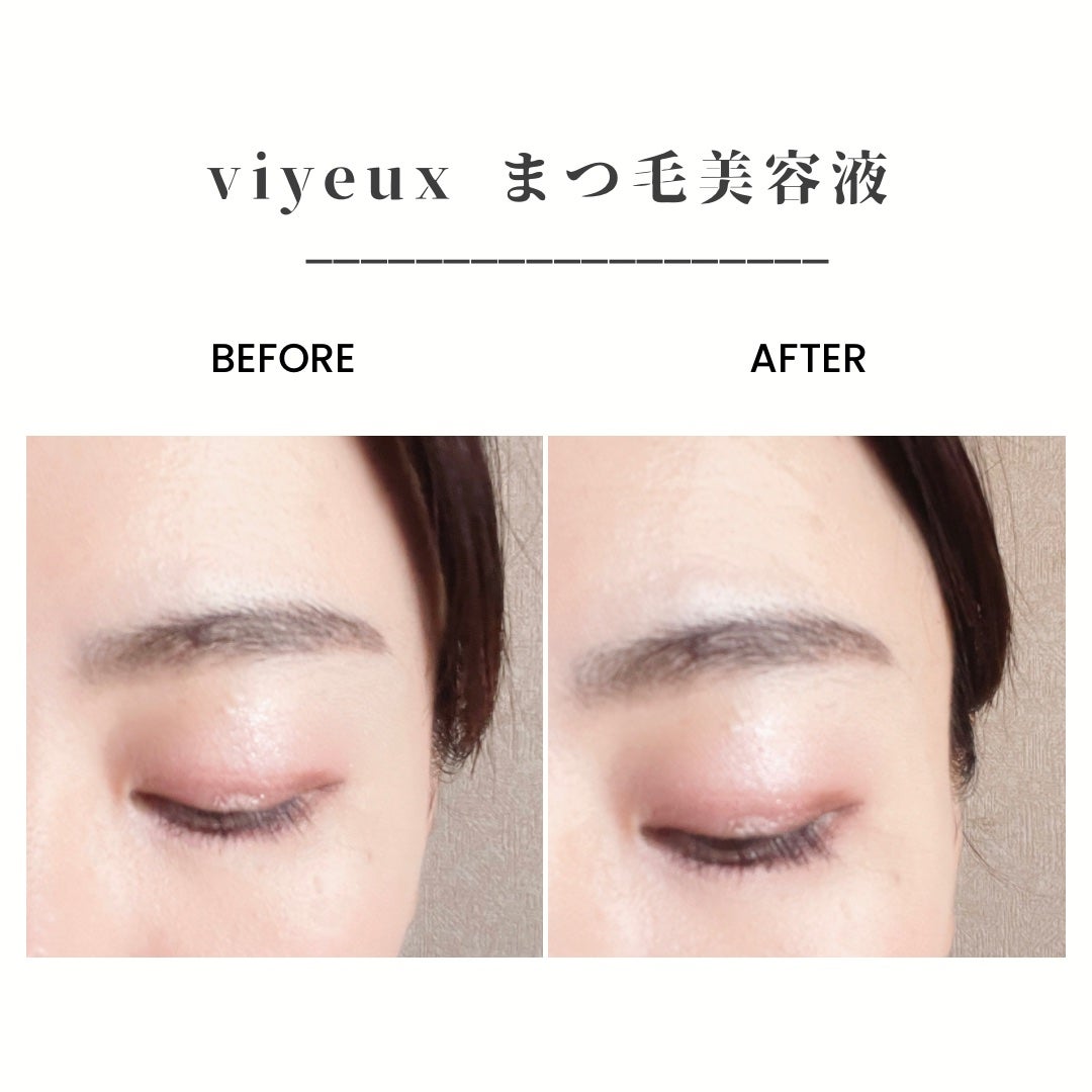 アイラッシュセラム/VIYEUX/まつげ美容液を使ったクチコミ(2枚目)