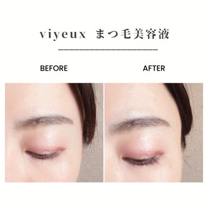 アイラッシュセラム/VIYEUX/まつげ美容液を使ったクチコミ(2枚目)