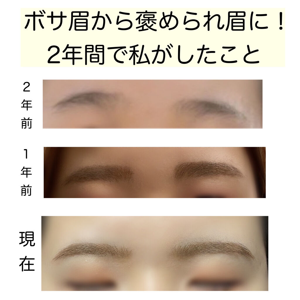 プレミア敏感肌用 Lディスポ/シック/シェーバーを使ったクチコミ（1枚目）