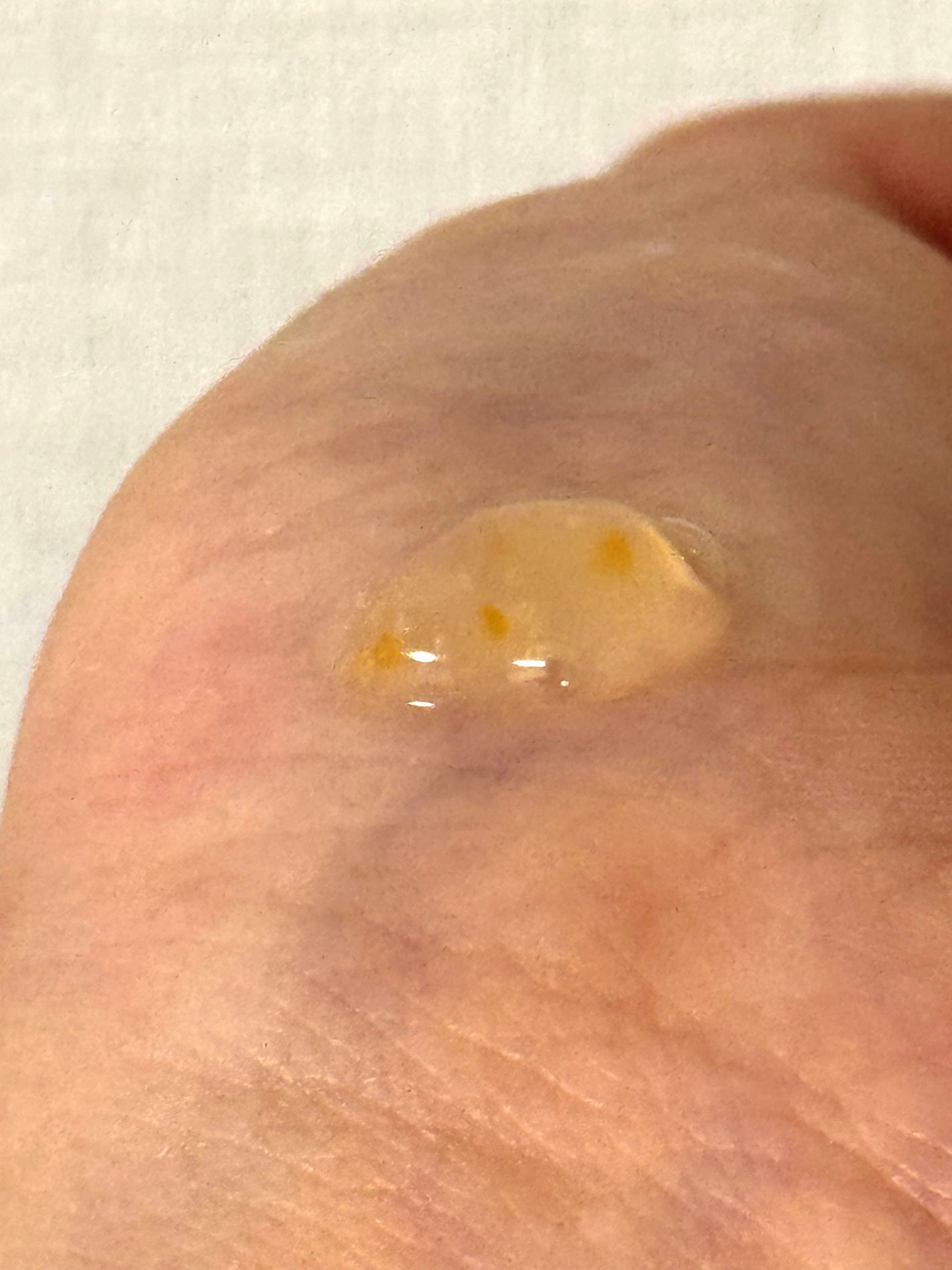 ビタライト リードルショット100/VT/ブースター・導入液を使ったクチコミ(2枚目)