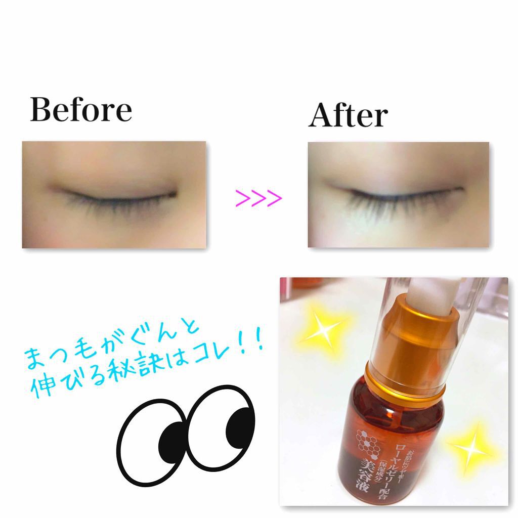 ローヤルゼリー配合 栄養ローション Daisoの使い方を徹底解説 超優秀 100均で買えるおすすめ美容液 Rjローション By Y 乾燥肌 10代後半 Lips ローヤルゼリー配合 栄養ローション Daisoの使い方を徹底解説 超優秀 100均で買えるおすすめ美容液 Rjローション By Y 乾燥肌 10代後半 Lips