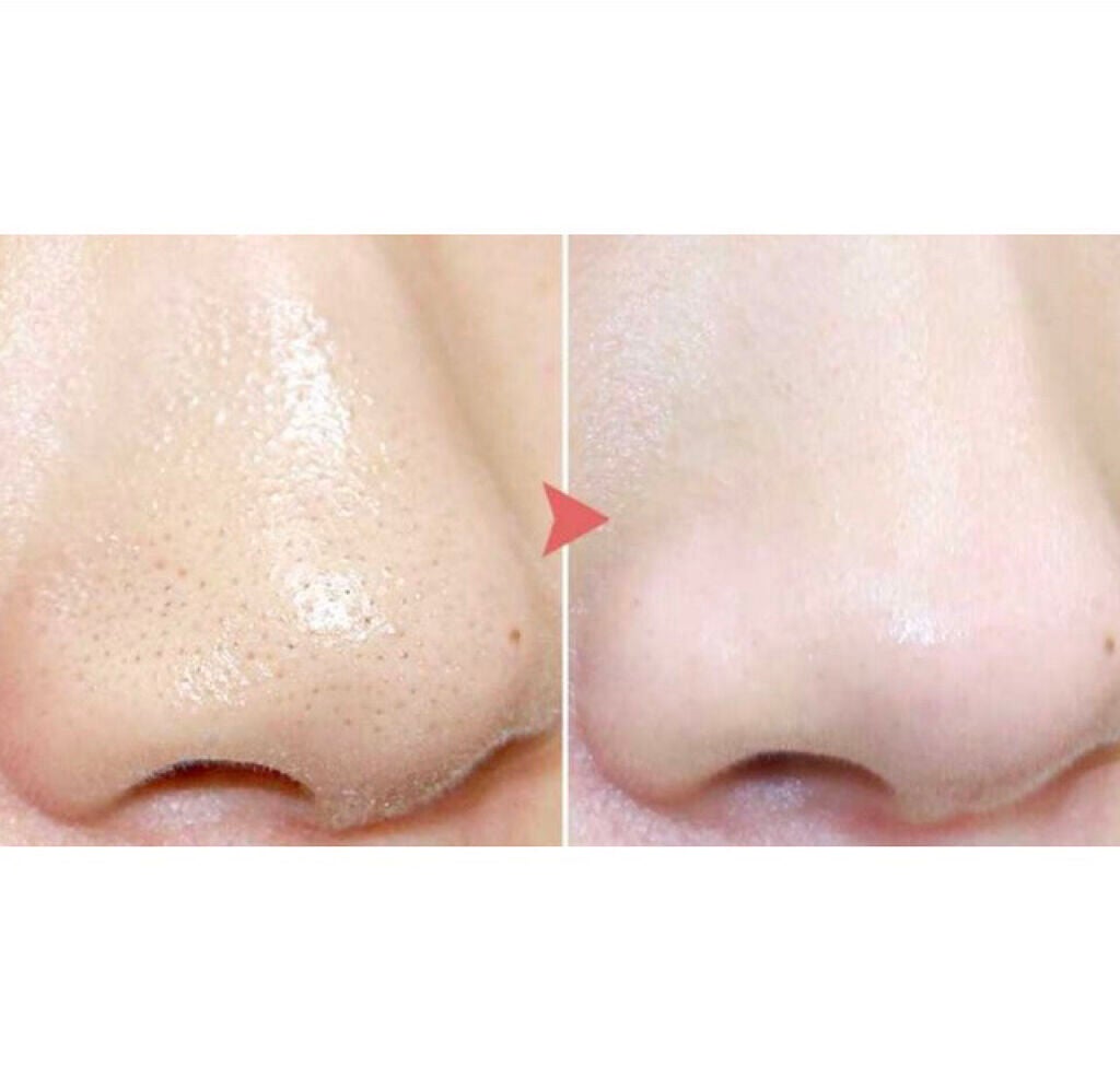 ホホバオイル/無印良品/ボディオイルを使ったクチコミ(2枚目)