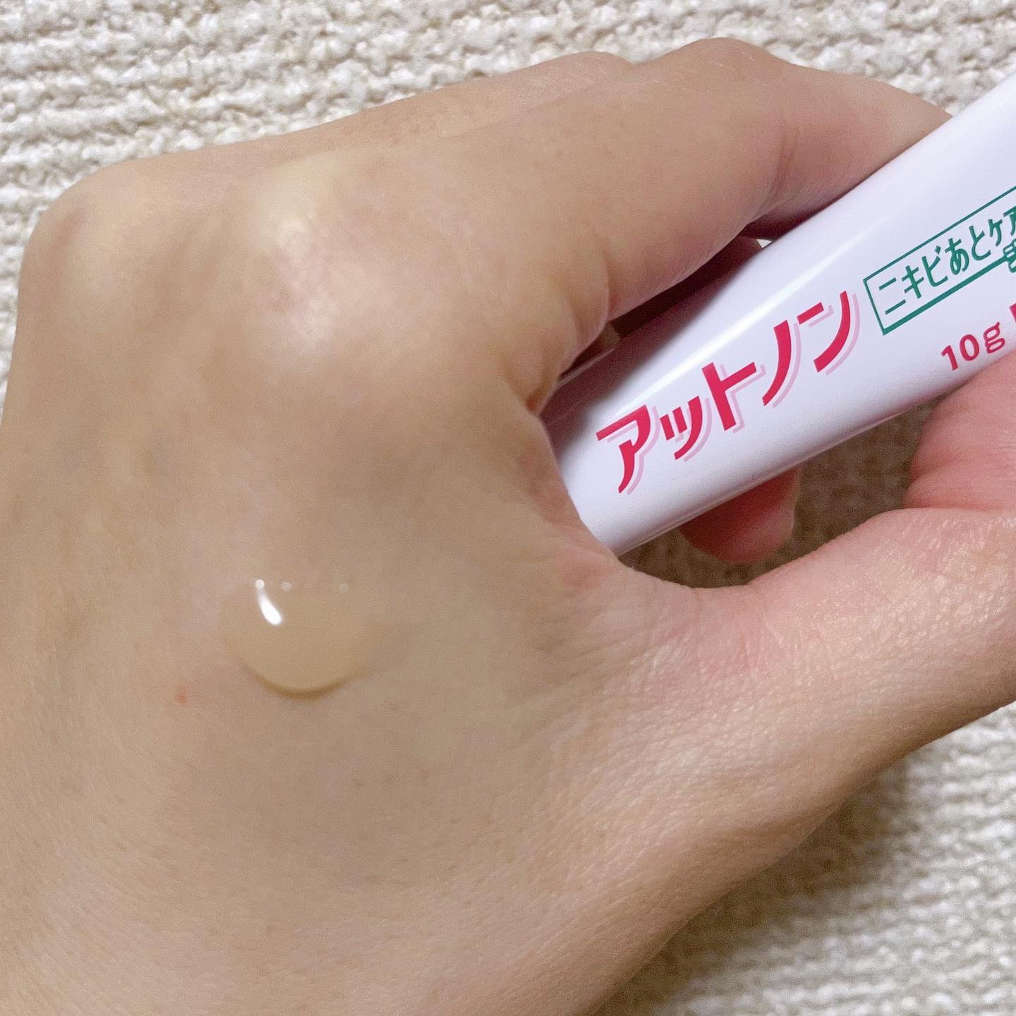 ニキビあとケアジェル/アットノン/その他スキンケアを使ったクチコミ（3枚目）