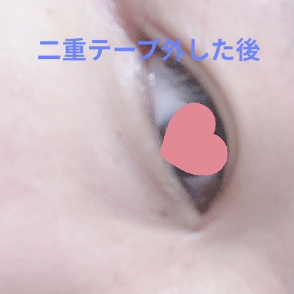 理想のふたえ ぱっちり幅広 ヌーディーワイド/セリア/二重まぶた用アイテムを使ったクチコミ（2枚目）