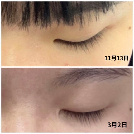 スカルプD ボーテ ピュアフリーアイラッシュセラム/アンファー(スカルプD)/まつげ美容液を使ったクチコミ(3枚目)