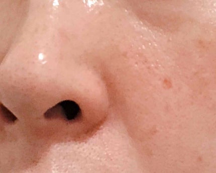 Cセラム/b.glen/美容液を使ったクチコミ(2枚目)