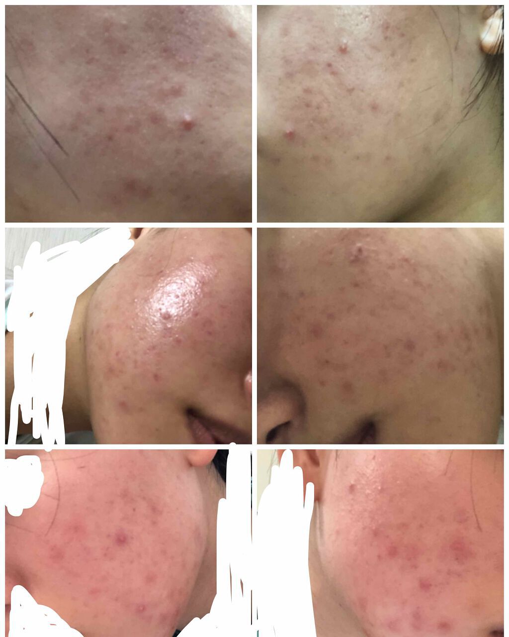 ミノン アミノモイスト モイストチャージ ローションI しっとりタイプ/ミノン/化粧水を使ったクチコミ（2枚目）