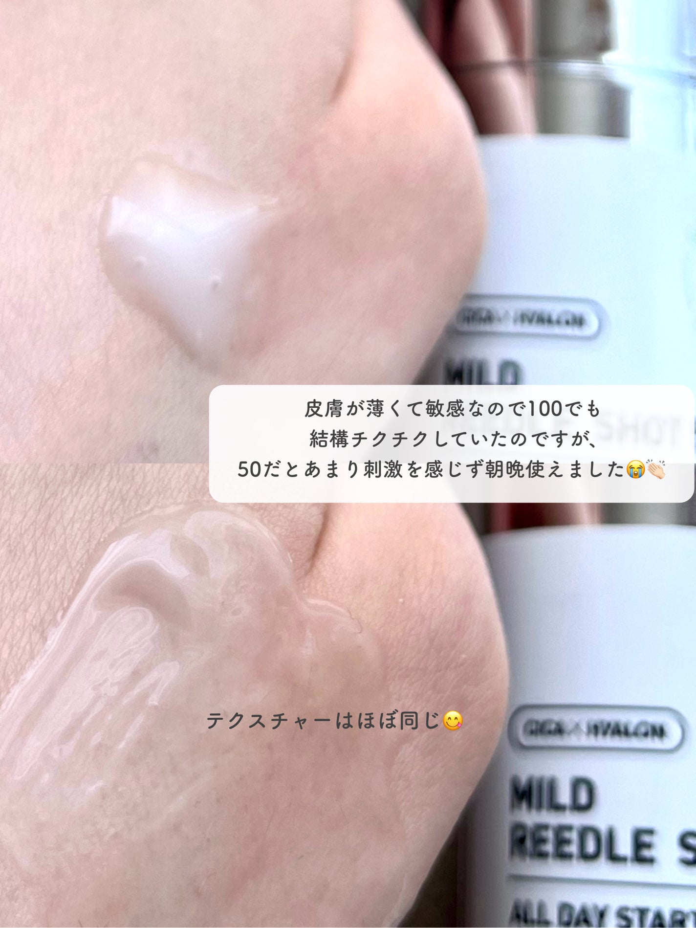 マイルドリードルショット50/VT/美容液を使ったクチコミ(3枚目)