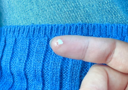 メディカルクリームc(医薬品)/メンソレータム アクネス25/その他を使ったクチコミ(6枚目)