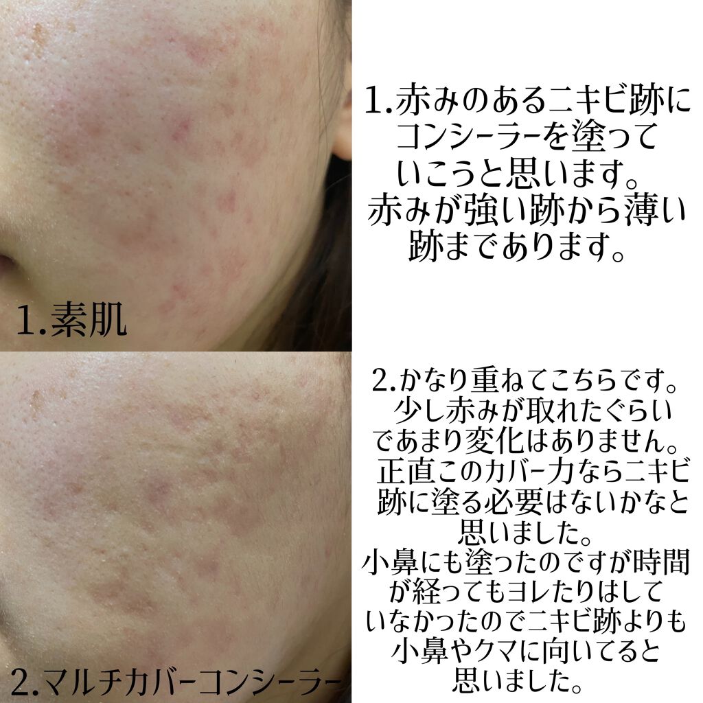 マルチカバー コンシーラー/ESPRIQUE/リキッドコンシーラーを使ったクチコミ（3枚目）