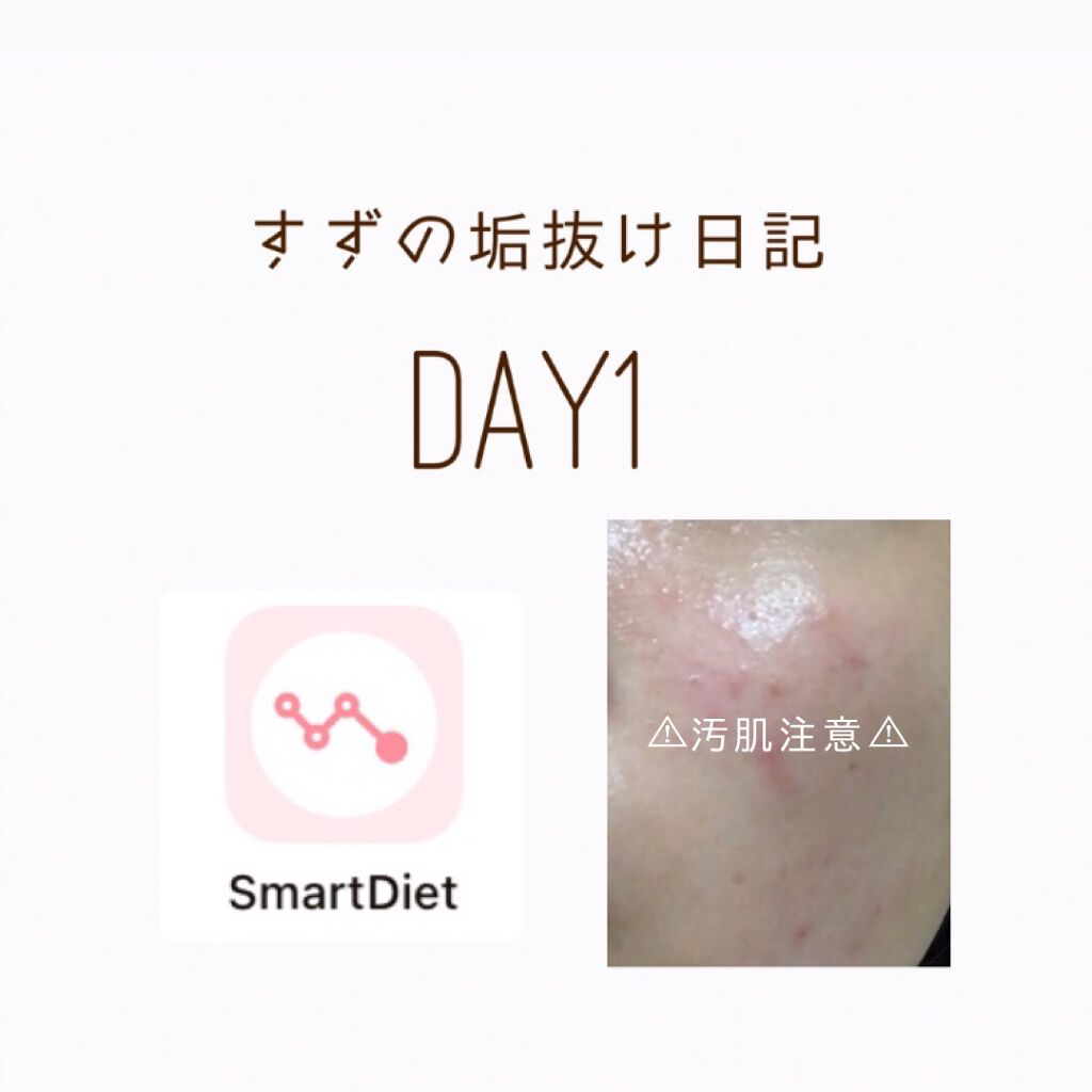 Suz on LIPS 「#すずの垢抜け日記DAY1早速更新です✊🏻❕暇な時に見ていただ..」(1枚目)