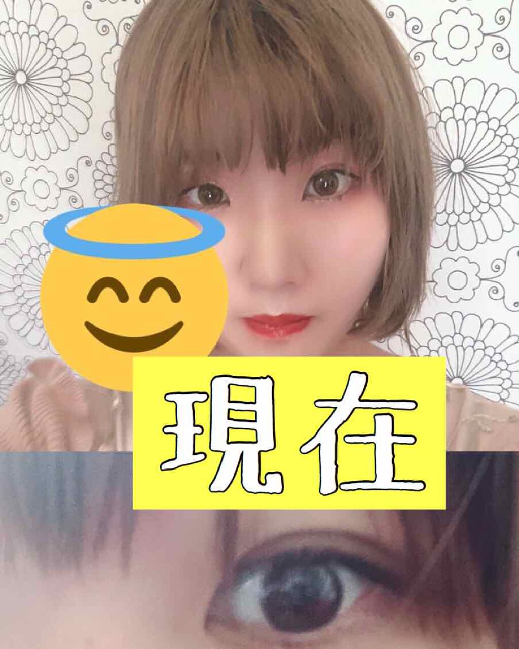 綺 on LIPS 「※2枚目以降ダウンタイムの写真があります。ご注意ください。二重..」(4枚目)