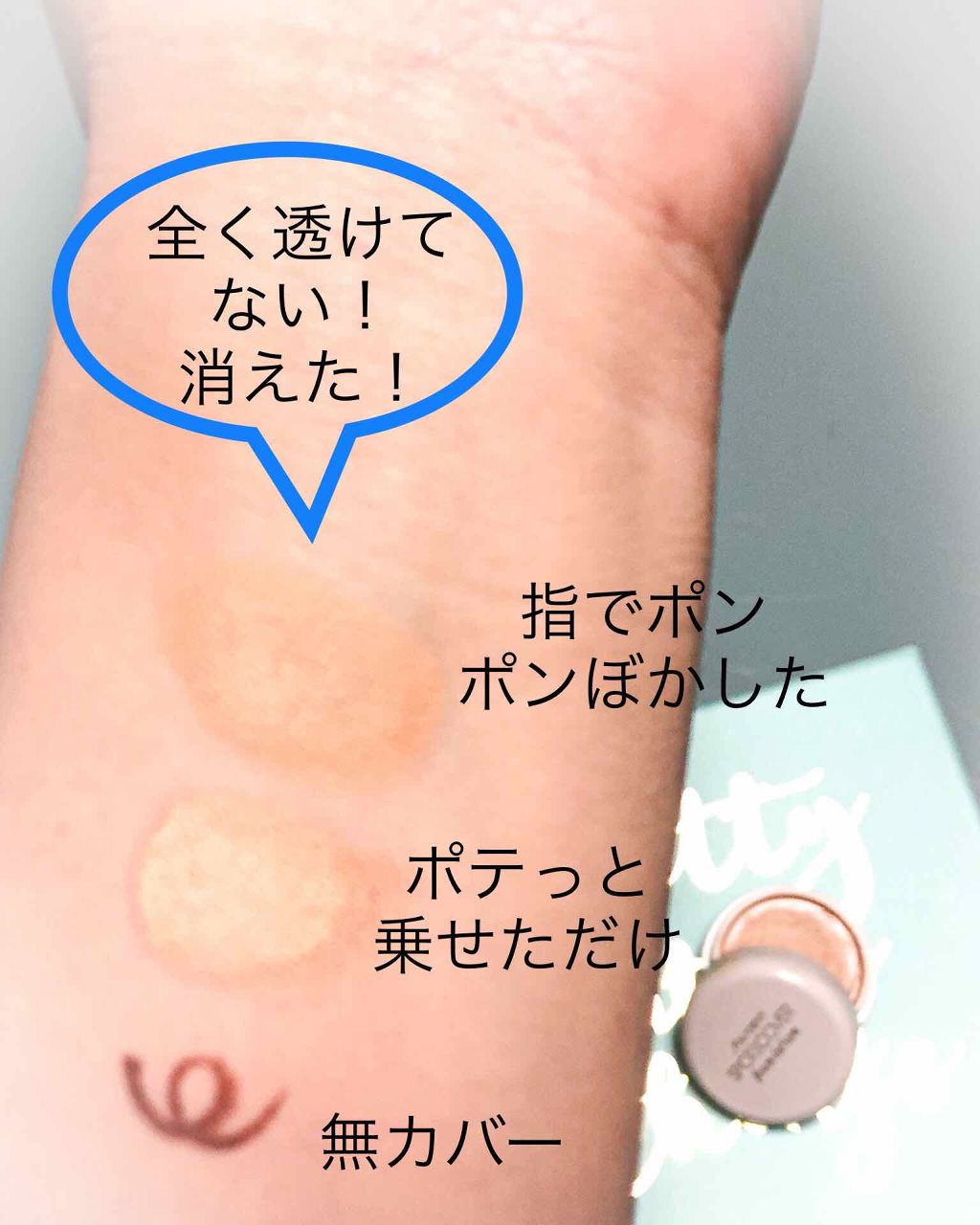 スポッツカバー ファウンデイション/SHISEIDO/クリームコンシーラーを使ったクチコミ(4枚目)