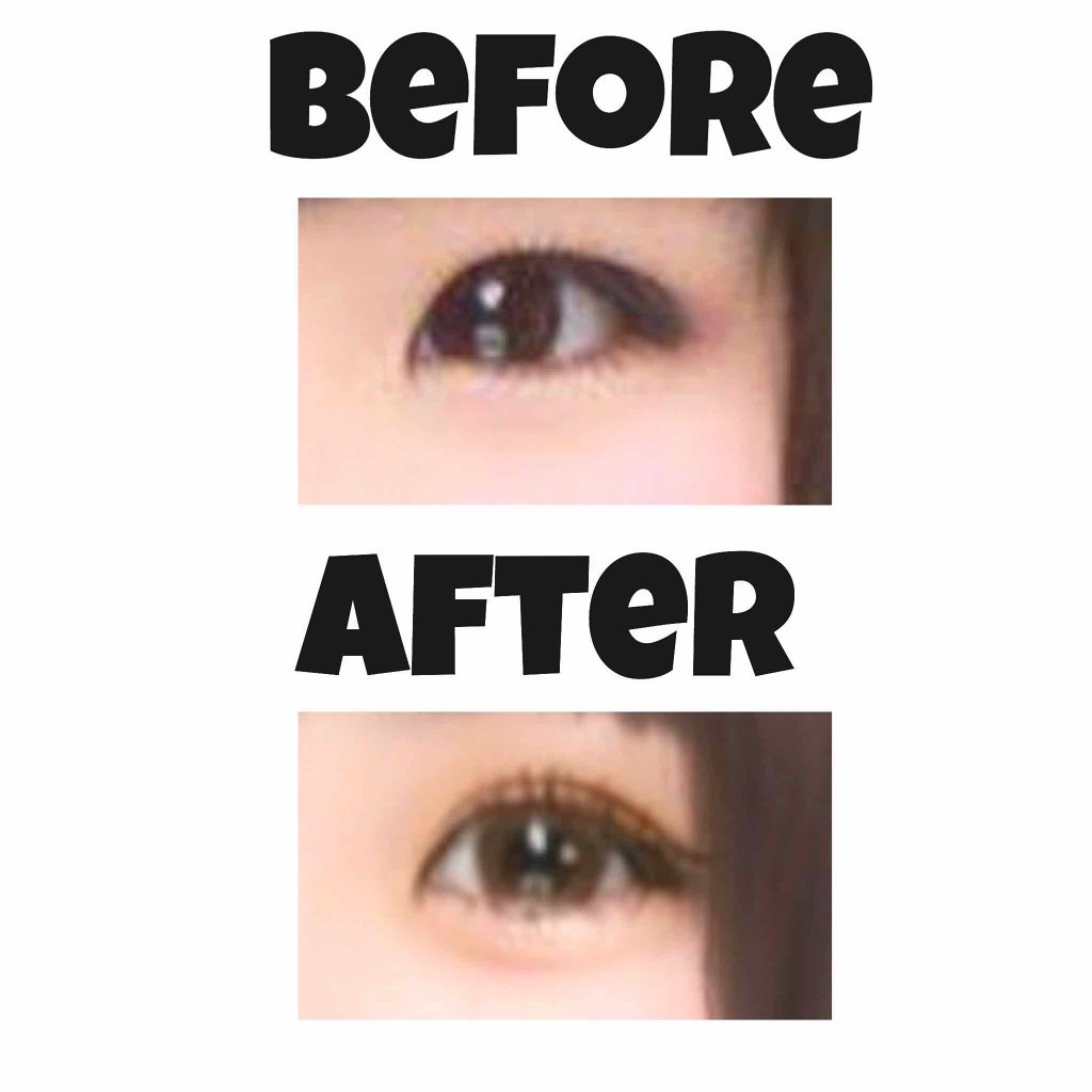 のびーるアイテープ（絆創膏タイプ、レギュラー）/DAISO/二重まぶた用アイテムを使ったクチコミ（1枚目）