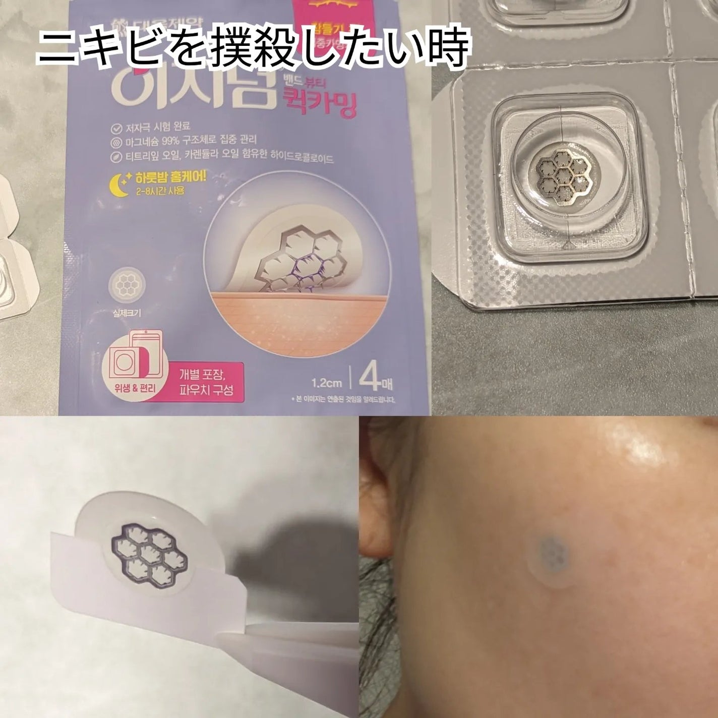 ビューティー スポットパッチ/イージーダムビューティー/にきびパッチを使ったクチコミ(4枚目)