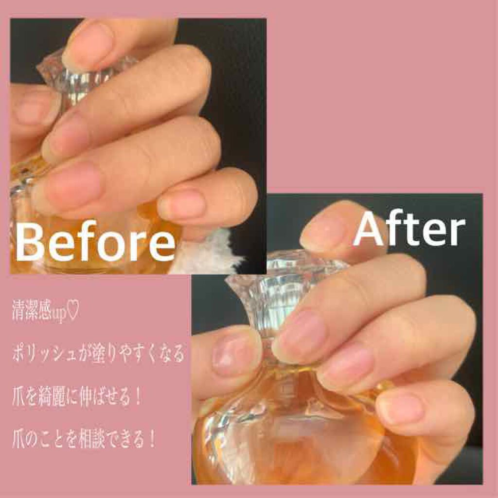 rinnko on LIPS 「ネイルケアのススメ!爪のケアについて書こうと思います。今まで私..」(1枚目)