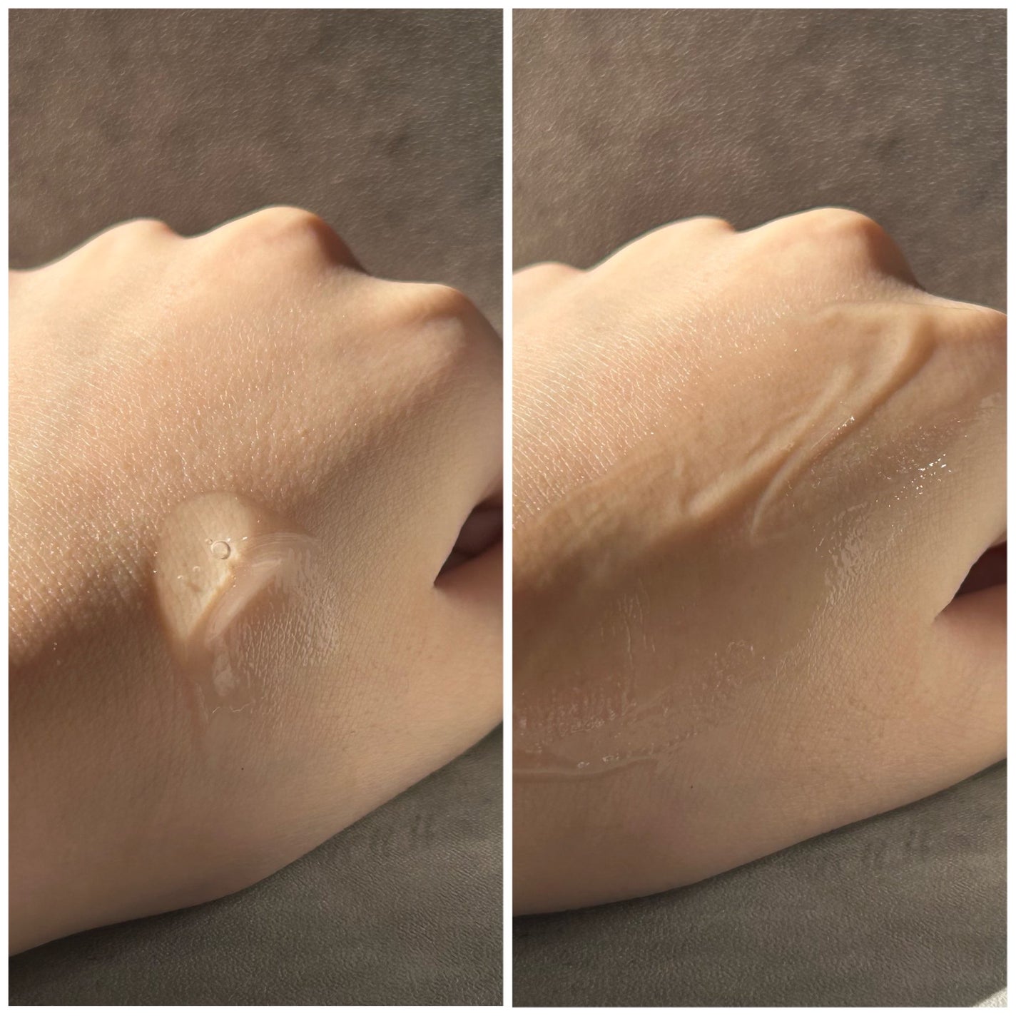 エーキュアトラブルカーミングセラム/obsero/美容液を使ったクチコミ(3枚目)