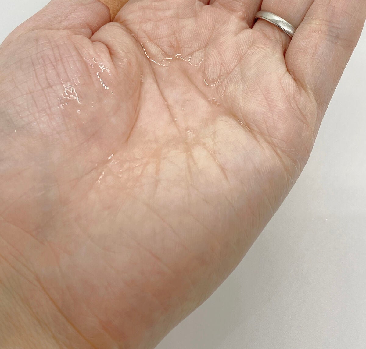 ピンクハーブクレンジング/ACNAL/オイルクレンジングを使ったクチコミ(4枚目)