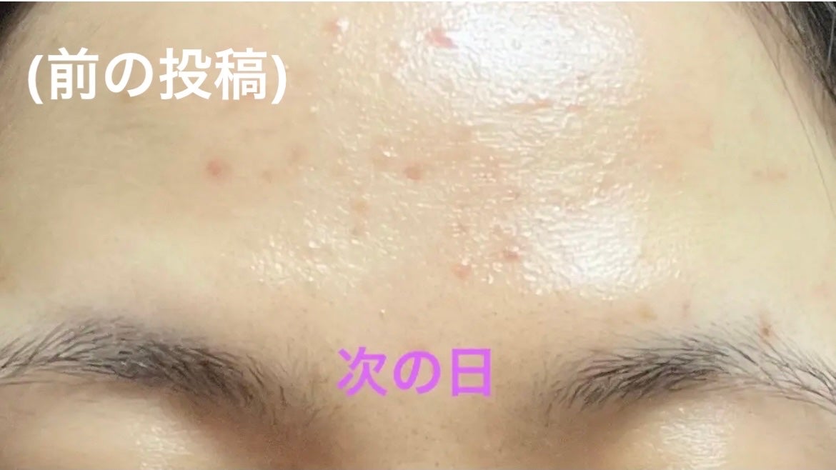 グルタ ビタミンC トーニング アンプル/IOPE/美容液を使ったクチコミ(3枚目)