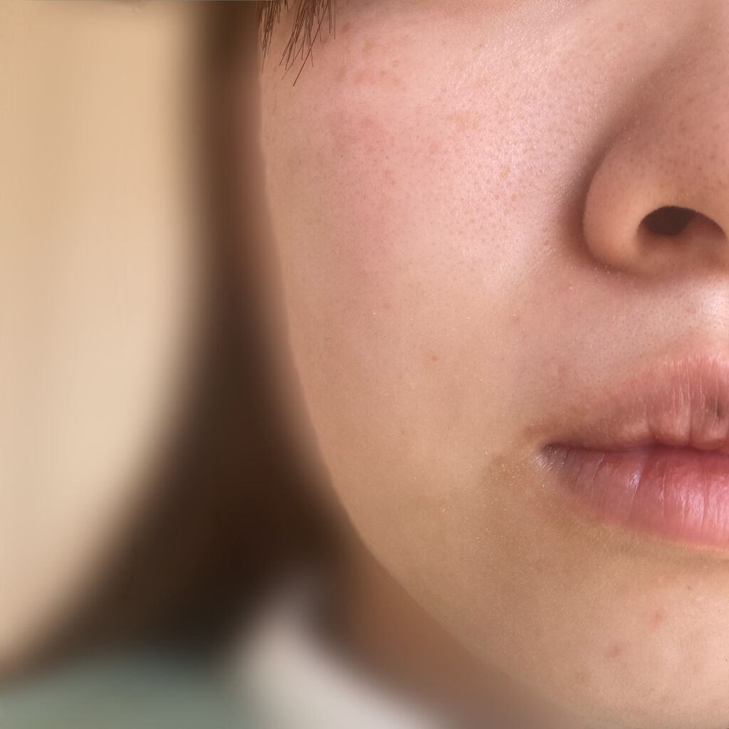 ノーモアブラックヘッド(ノーズピーリング)/One-day's you/スクラブ・ゴマージュを使ったクチコミ（2枚目）