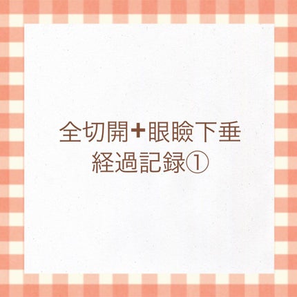 二重整形/その他を使ったクチコミ(1枚目)