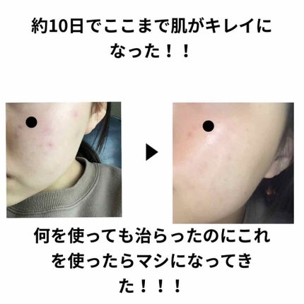 明色美顔水 薬用化粧水/美顔/化粧水を使ったクチコミ(1枚目)