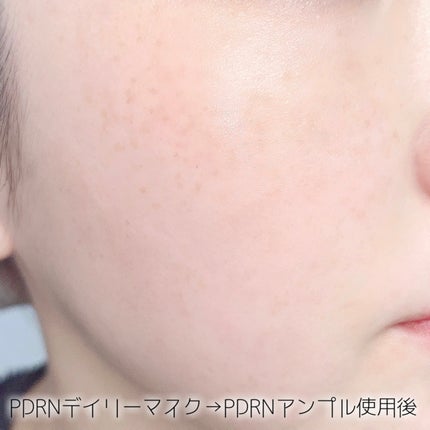 PDRN+ デイリーマスク/VT/シートマスク・パックを使ったクチコミ(5枚目)
