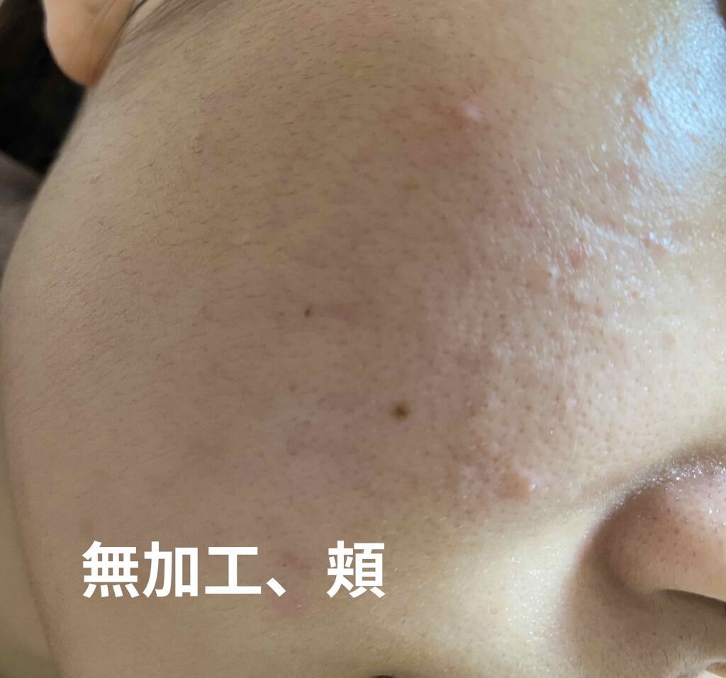 化粧水 NA/なめらか本舗/化粧水を使ったクチコミ（3枚目）