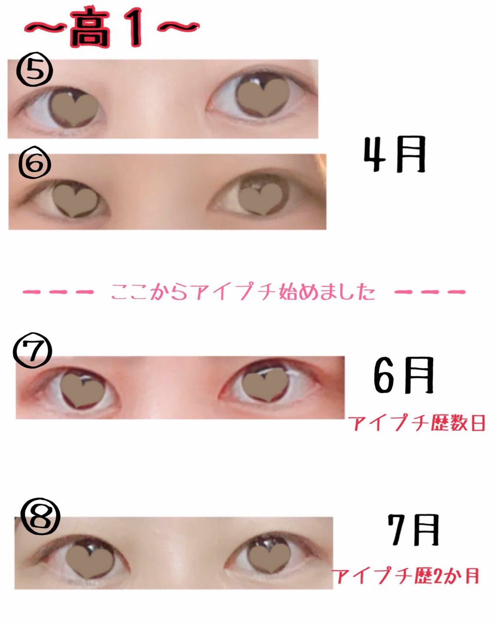 ワンダーアイリッドテープ Extra/D-UP/二重まぶた用アイテムを使ったクチコミ(3枚目)