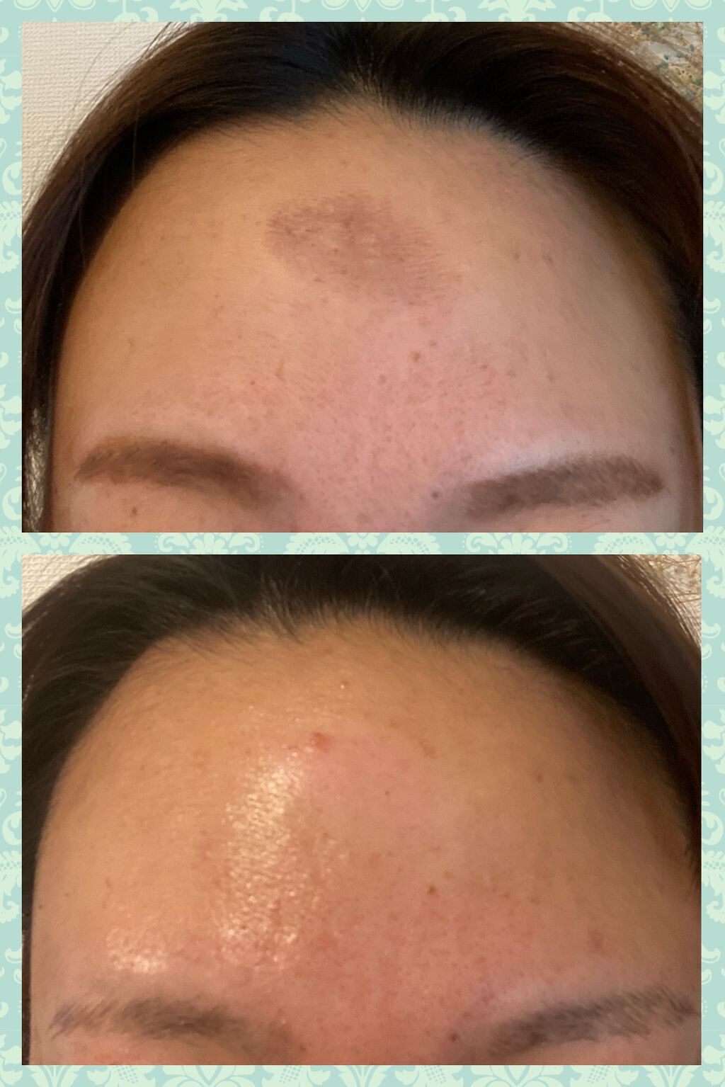 ビタペアC 集中美容液スペシャルセット/ネイチャーリパブリック/美容液を使ったクチコミ（2枚目）