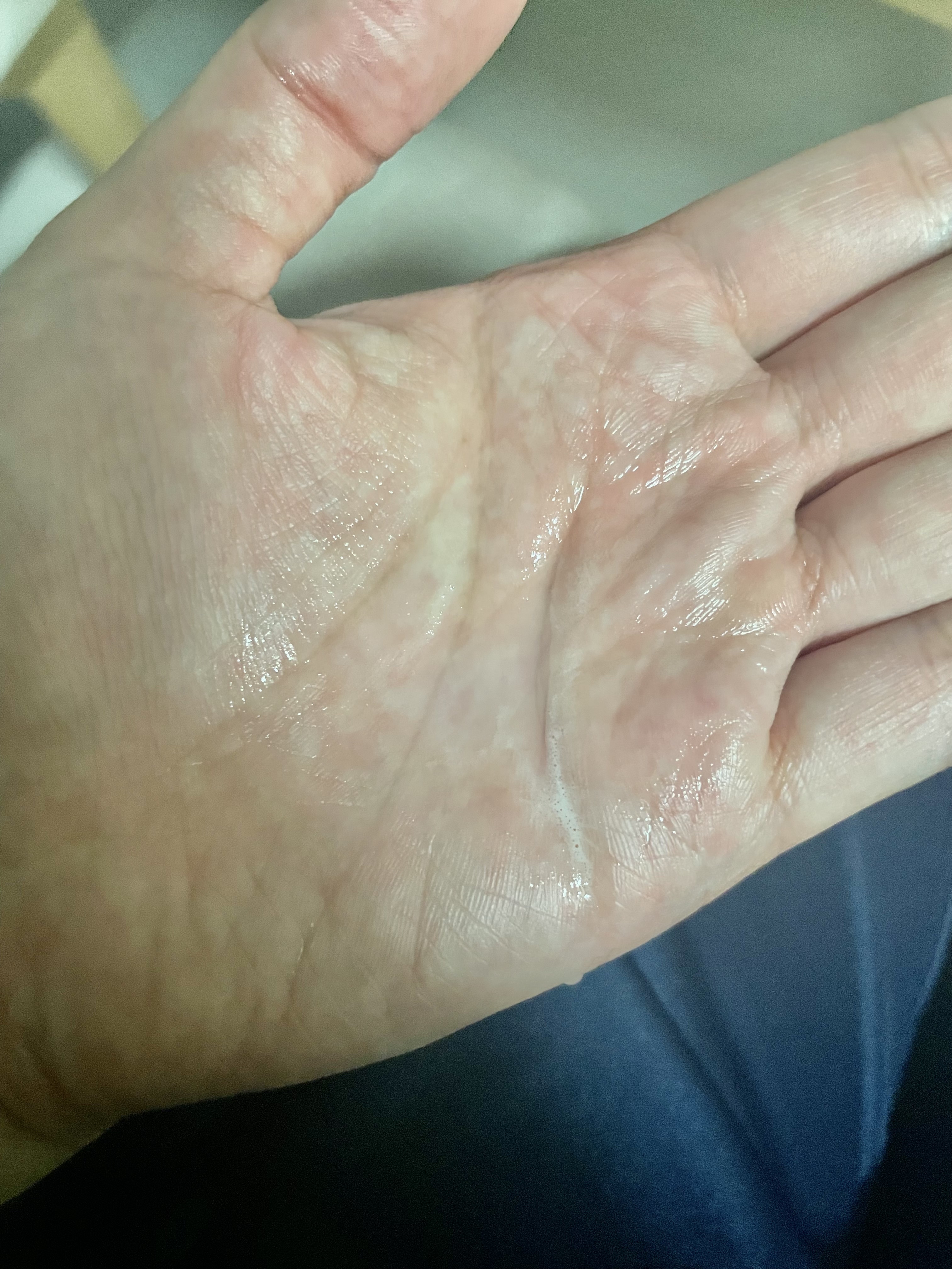 ハトムギ化粧水(ナチュリエ スキンコンディショナー R )/ナチュリエ/化粧水を使ったクチコミ（2枚目）