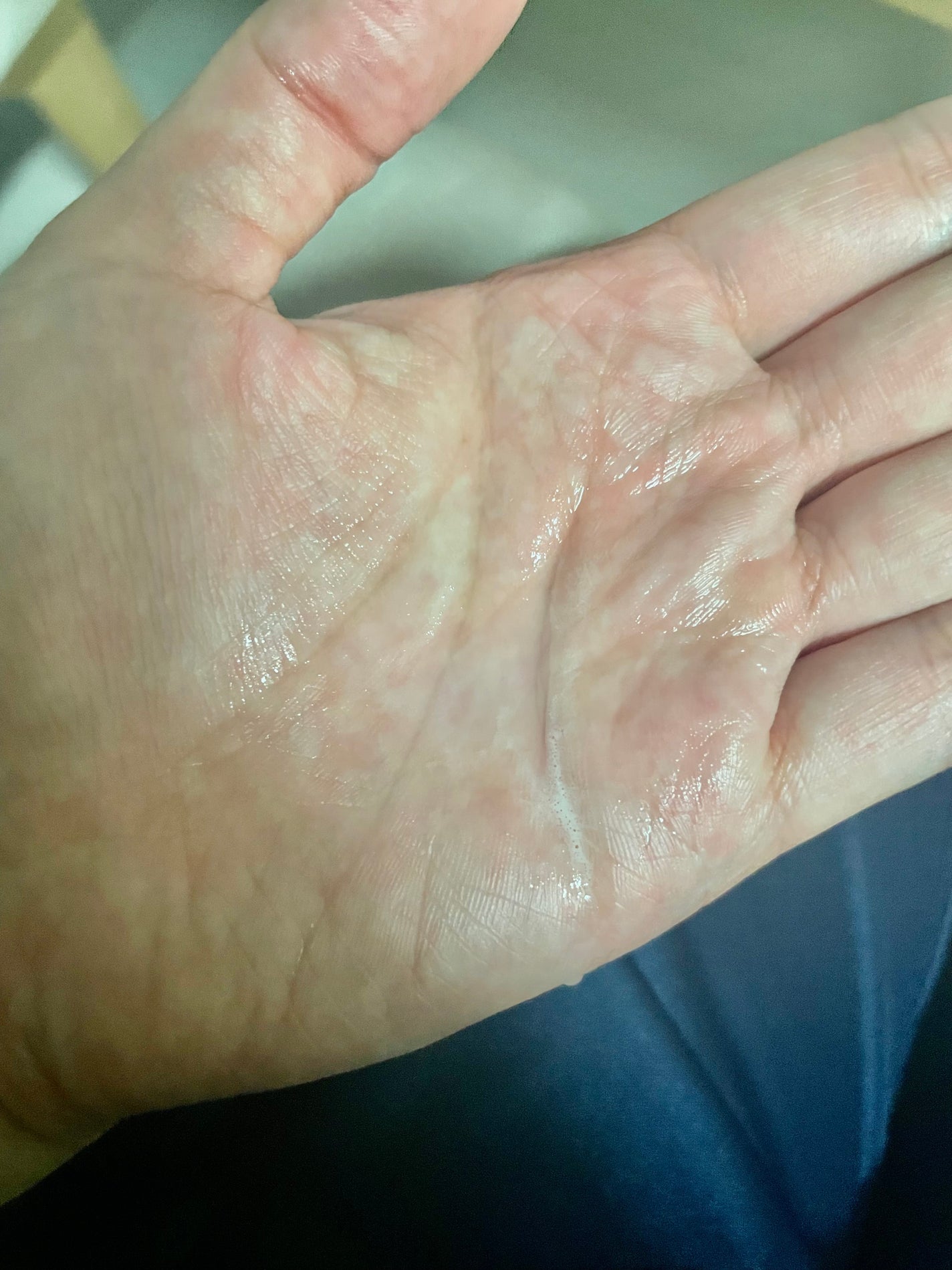 ハトムギ化粧水(ナチュリエ スキンコンディショナー R )/ナチュリエ/化粧水を使ったクチコミ(2枚目)