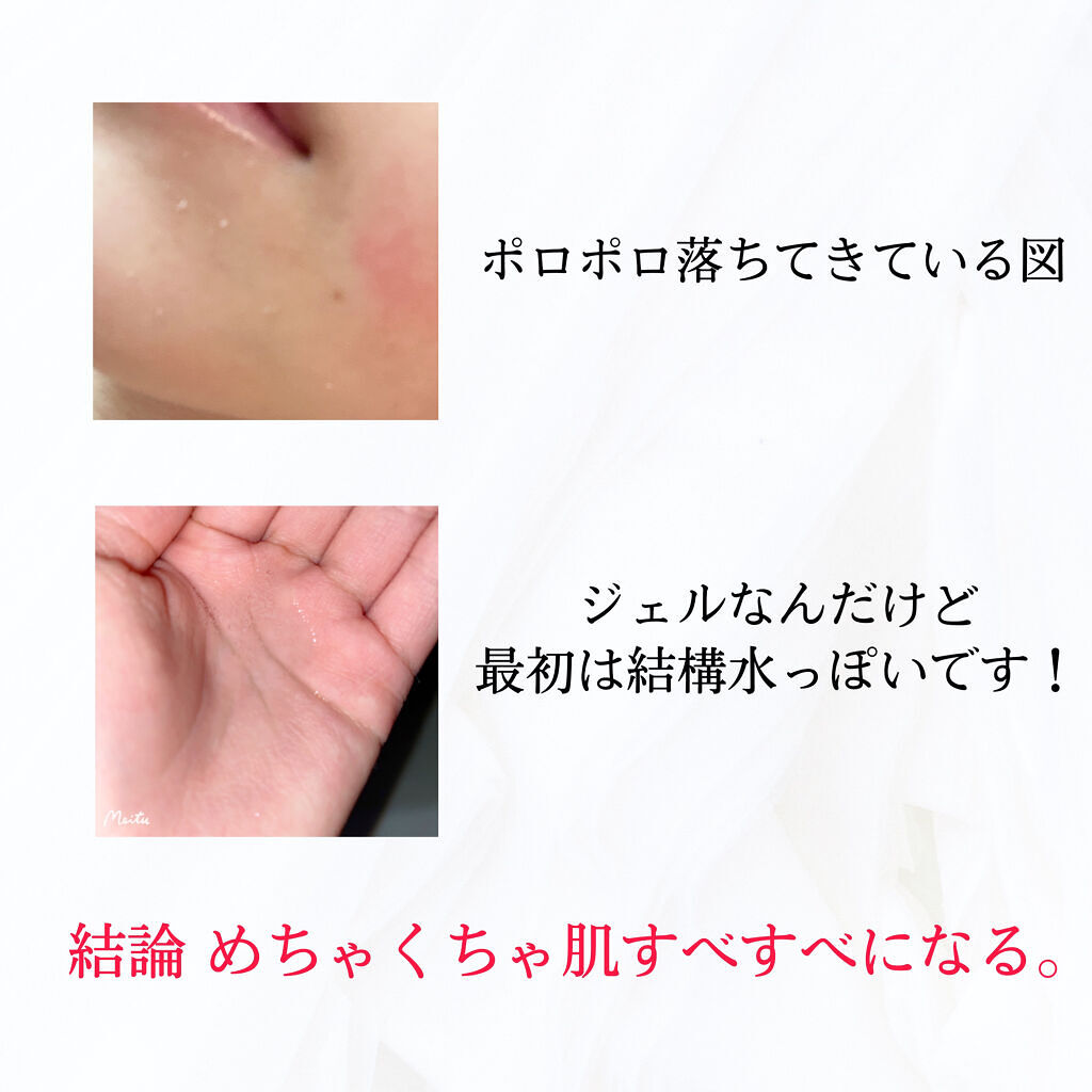 ナチュラルアクアジェル/Cure/ピーリングを使ったクチコミ（2枚目）