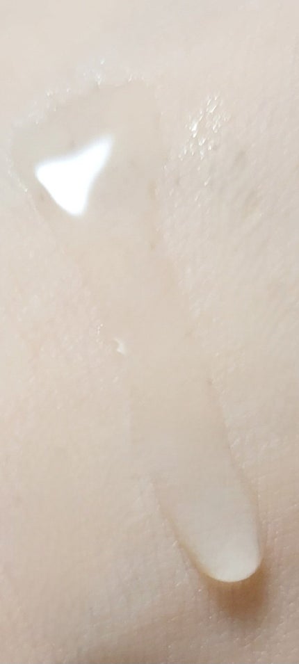 ダーマレーザー スーパーVC100ローション(しっとり)/クオリティファースト/化粧水を使ったクチコミ(2枚目)