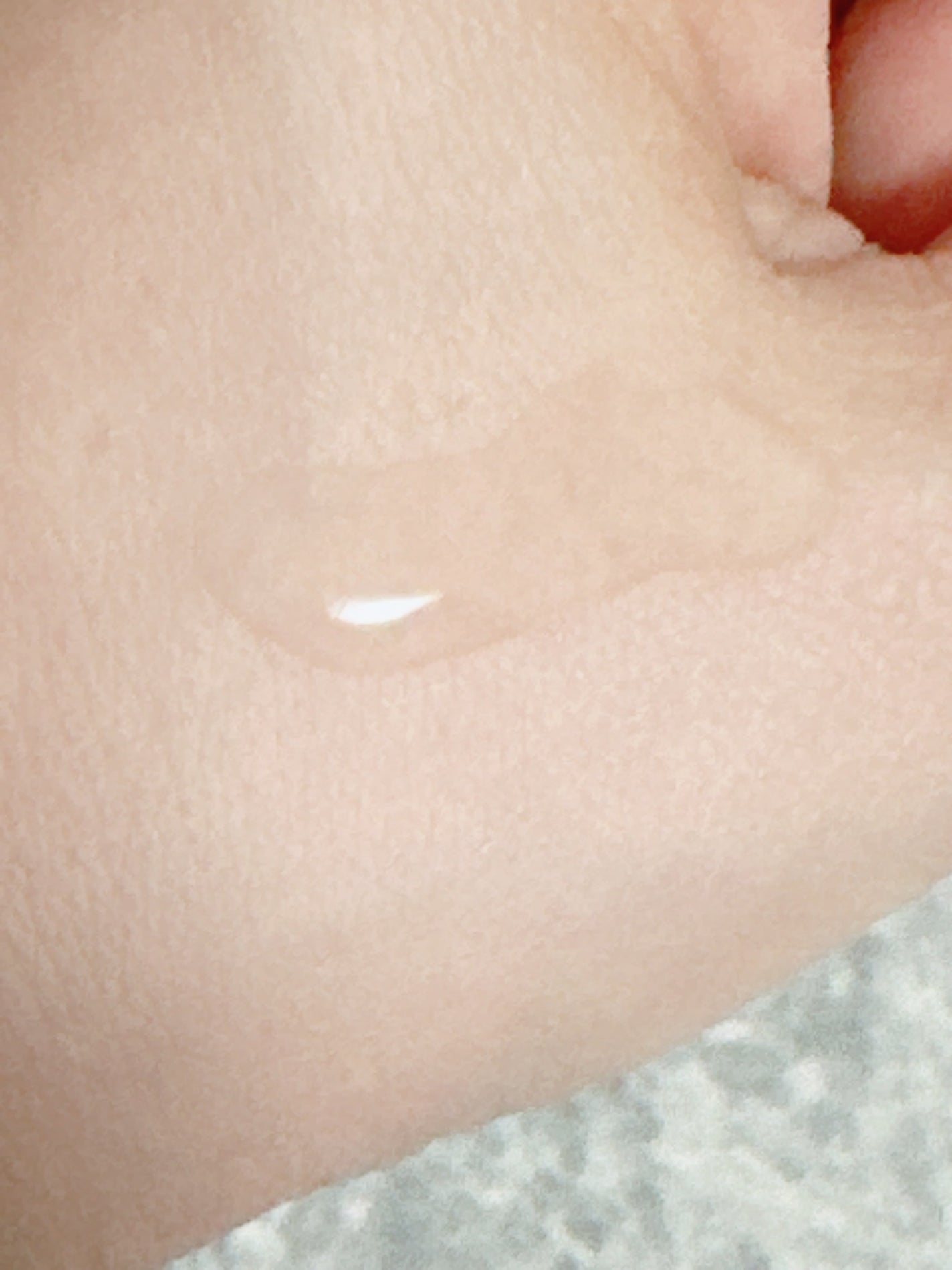 ノスカナイン トラブル セラム/FATION/美容液を使ったクチコミ(4枚目)