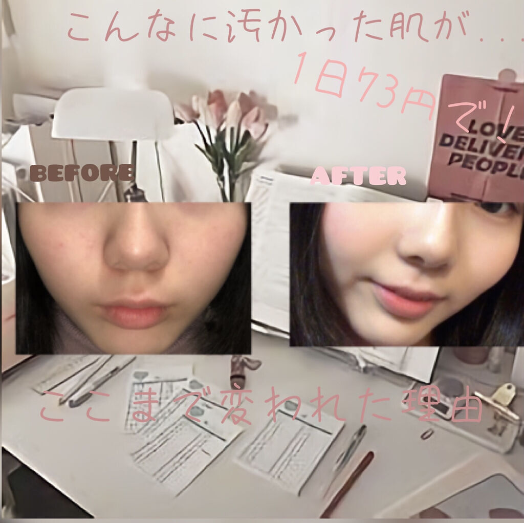 CICA デイリースージングマスク/VT/シートマスク・パックを使ったクチコミ（1枚目）