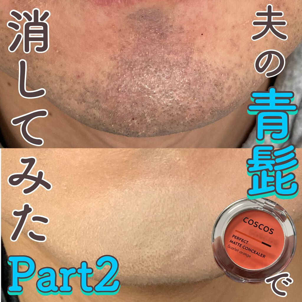 パーフェクトマットコンシーラー スカーレットオレンジ Coscosの口コミ 夫の青髭消してみた Part2coscos By ふくすけ 混合肌 30代前半 Lips