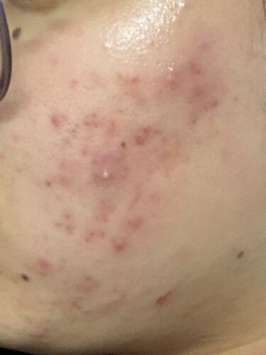 デュオ ザ 薬用クレンジングバーム バリア Duoの口コミ 最近噂のduoというくそ高ぇクレンジングを By とろり 混合肌 代前半 Lips