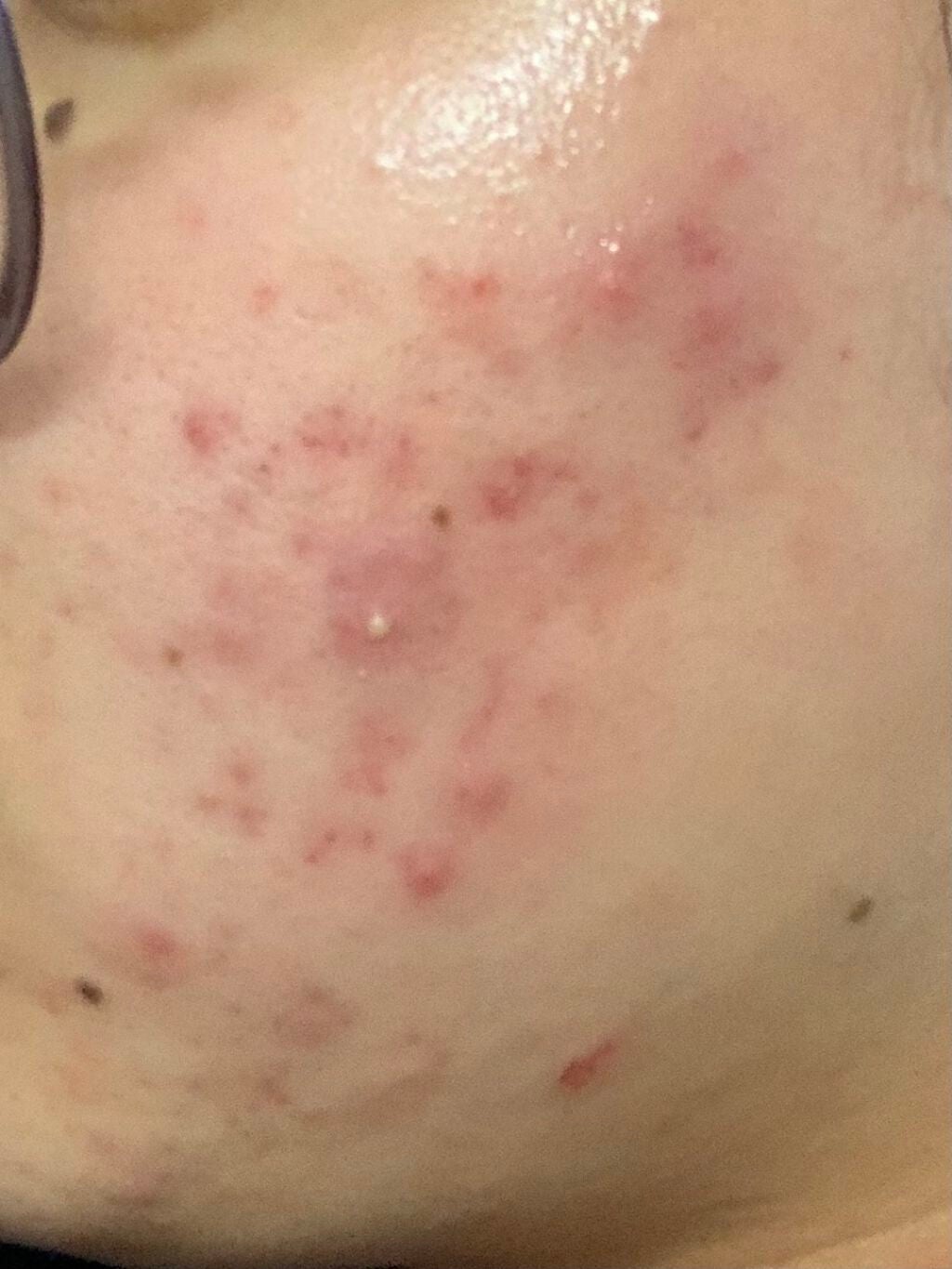 デュオ ザ 薬用クレンジングバーム バリア【医薬部外品】/DUO/クレンジングバームを使ったクチコミ(2枚目)