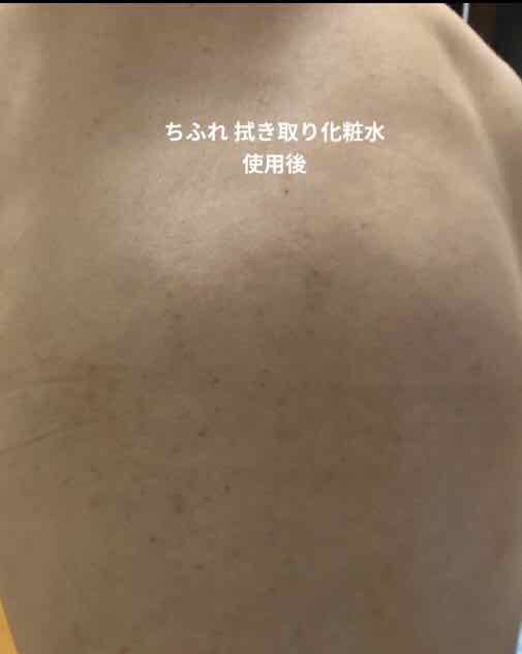 ふきとり化粧水/ちふれ/拭き取り化粧水を使ったクチコミ（3枚目）