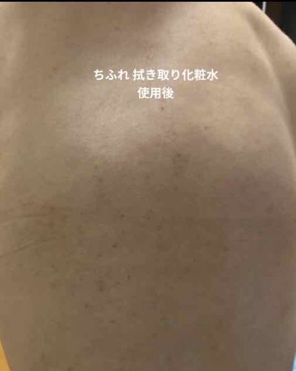 ふきとり化粧水/ちふれ/拭き取り化粧水を使ったクチコミ(3枚目)