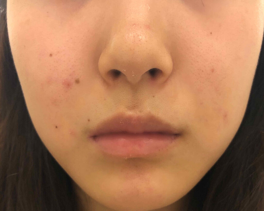 ザ・タイムR アクア/IPSA/化粧水を使ったクチコミ（3枚目）