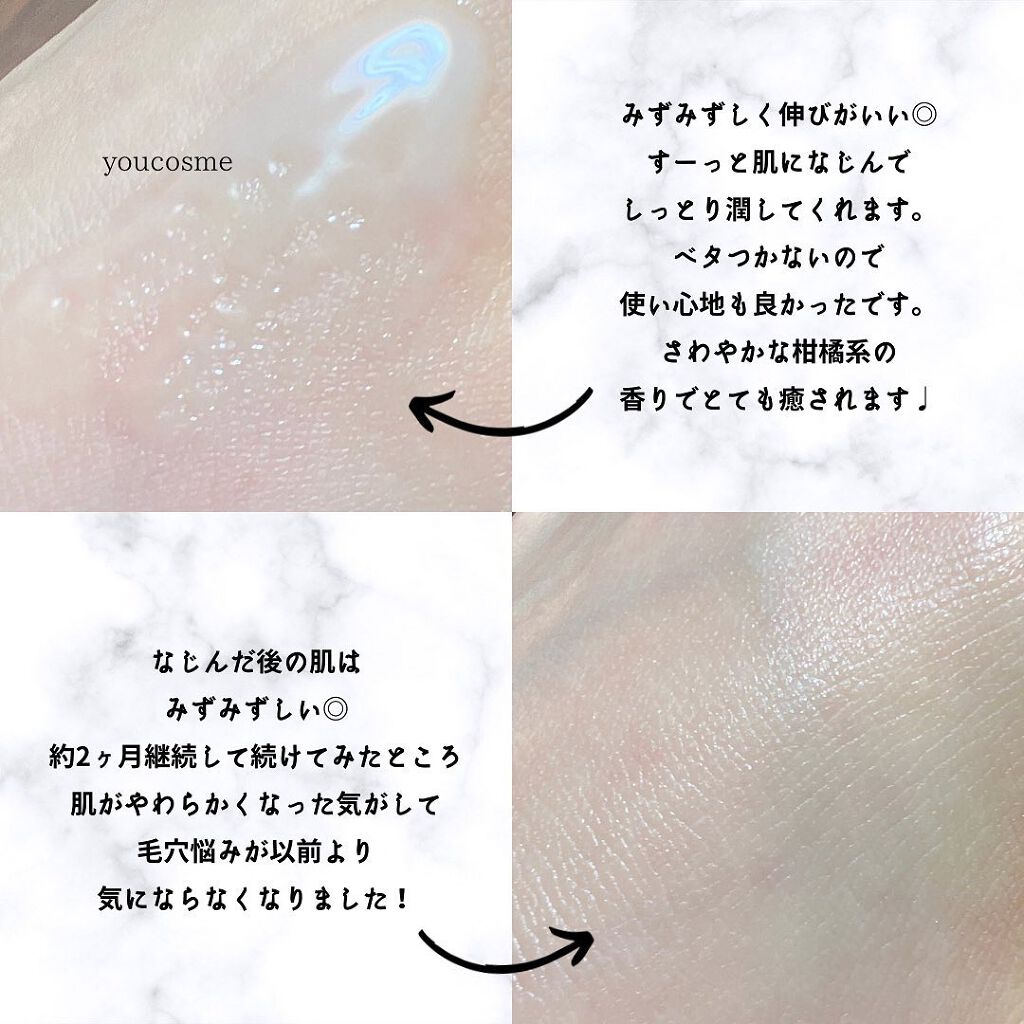 エンリッチCセラム/IGA LAB/美容液を使ったクチコミ(3枚目)