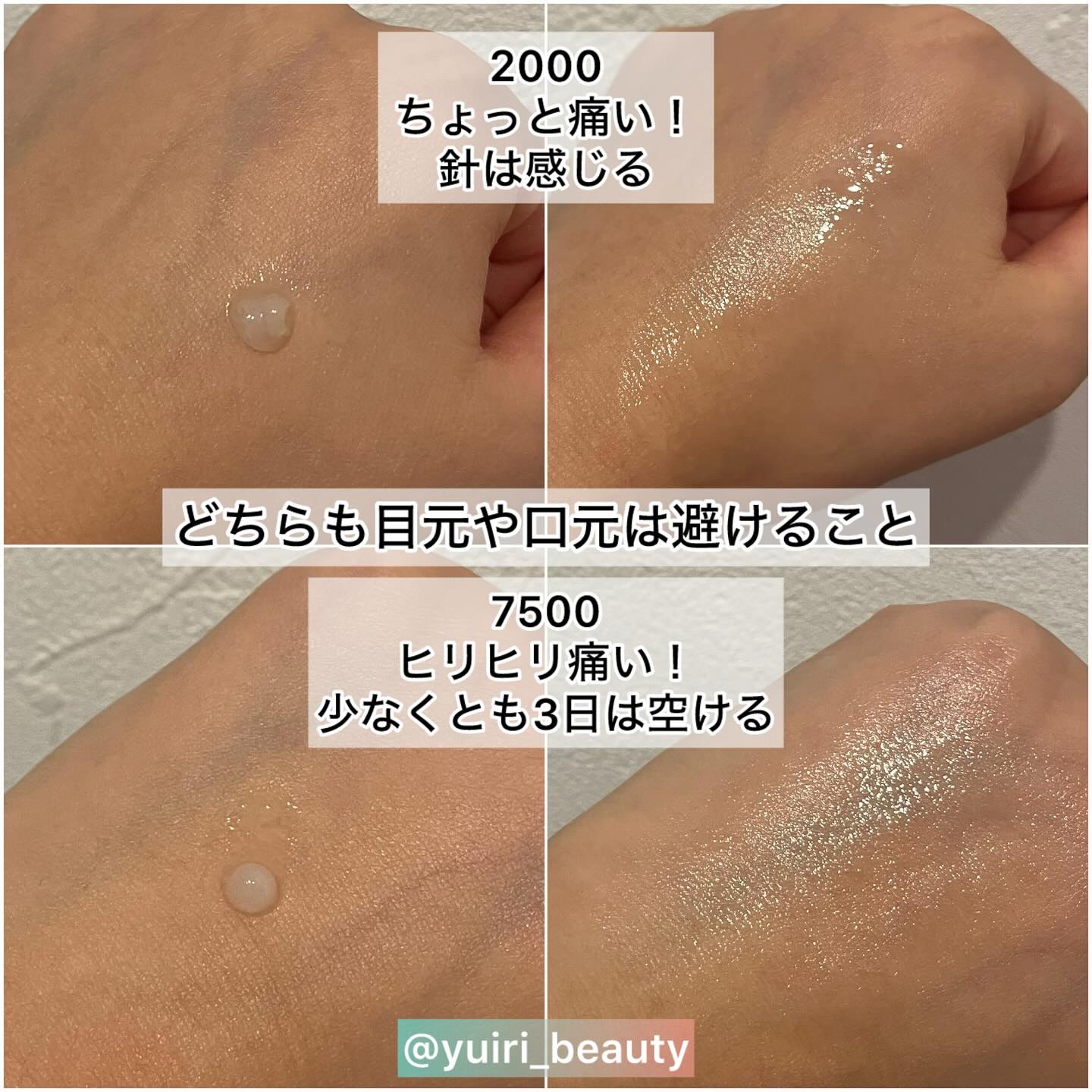 ゼロ1DAYエクソソームショット2000/MEDICUBE/美容液を使ったクチコミ（3枚目）